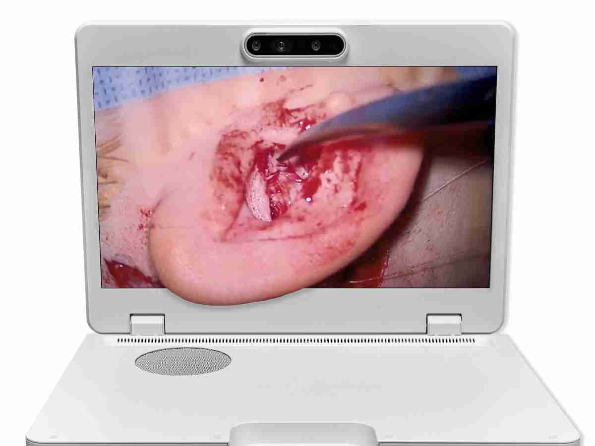 达擎之＂Heads-up 3D显微手术显示系统＂，，，，整合4K裸眼3D显示及眼球追踪系统，，，具备快速追踪人眼移动位置功能，，减轻医师长时间维持固定姿势的负担，，，，让医师能有更宽广清晰的3D立体视野及更舒适的姿势来执行手术。。。。